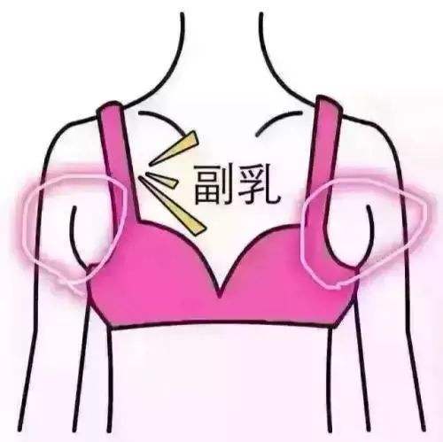 我们怎么做可以预防副乳的发生？|副乳切除术价格定位如何