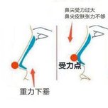 鼻整形失败多久能修复？|术后3个月可以修复吗？