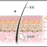 病理性脱发应该如何治疗？