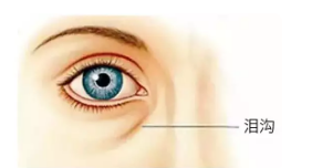 松弛型眼袋的主要发生原因有哪些？重庆时光给你解答。