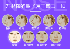 硅胶隆鼻需要多少钱?硅胶隆鼻价格跟假体的材质有关,推荐北京樱