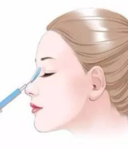 哈尔滨斯美诺医疗美容门诊部做隆鼻效果如何？有案例吗？