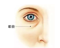 李燕专家解答微创去眼袋去眼袋的正确步骤，还有去眼袋价格表。
