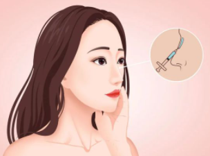 九江协和医疗美容门诊部做假体隆鼻大概可以维持多久？
