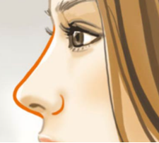 隆鼻矫正多长时间可以减轻肿胀？驼峰鼻价格的影响因素了解