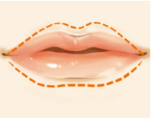脂肪丰唇的优点有哪些？嘴巴整形案例人人可以拥有迷人嘟嘟嘴！