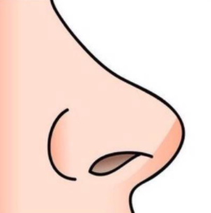 什么影响朝天鼻矫正的效果？术后注意事项有哪些？