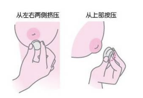 切除乳头持续时间有哪些?乳头乳晕缩小怎么样?亲身经历来告诉你