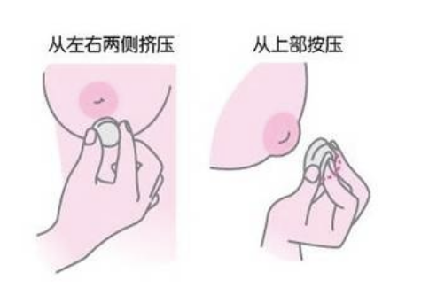 切除乳头持续时间有哪些？乳头乳晕缩小怎么样？亲身经历来告诉你