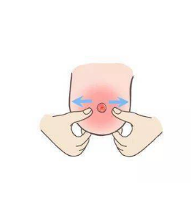 乳头缩小会有影响吗?乳头缩小半侧切除术原理有哪些?值得你关注
