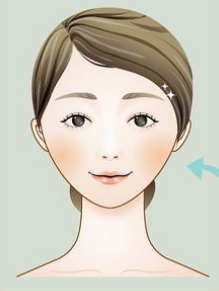 面部提肌抗衰效果如何？提肌真人案例！两个阶段发挥作用有哪些？