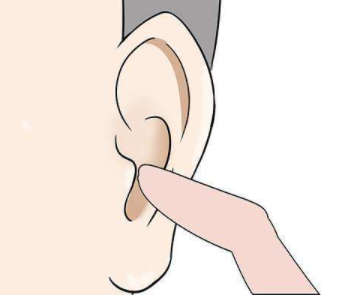 做耳朵再造手术有什么风险？术后要注意这些事项！