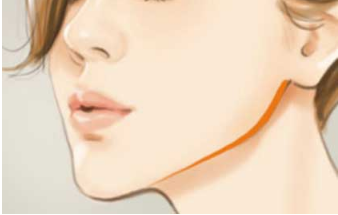 去除鼻唇沟的优势有哪些？法令纹术前准备！法令纹案例反馈如何！