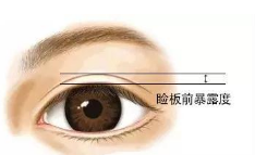 双眼皮不对称的原因是什么？全切双眼皮的注意事项有哪些？