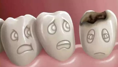 种植牙二期手术时间！种植牙可以吃骨头吗？附加价格表！