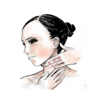 面部轮廓手术适合哪些人群？面部轮廓术后护理+磨骨价格表。