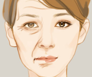 面部提升术效果好吗？术后该怎么护理才能持久呢？