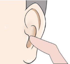 耳部整形的后遗症有哪些？选择耳整形医院的标准有哪些？