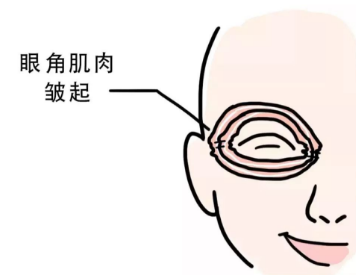 眼袋有什么办法可以消除的吗？激光祛眼袋的危害与效果！